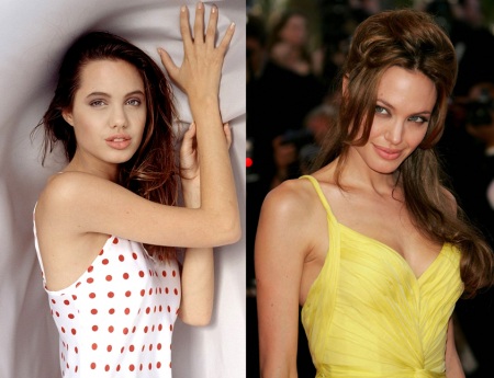 Анжелина Джоли – фото до и после пластических операций
