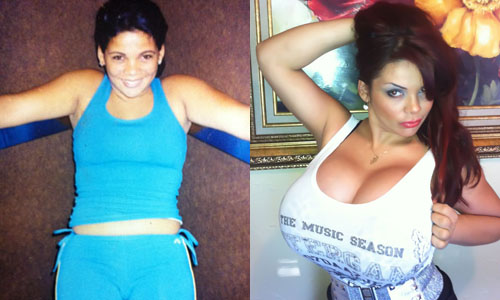 Шейла Херши – фото до и после пластических операций