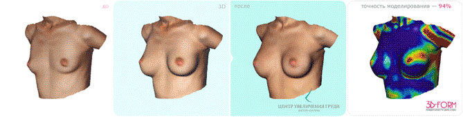 Моделирование груди с помощью методики 3D FORM