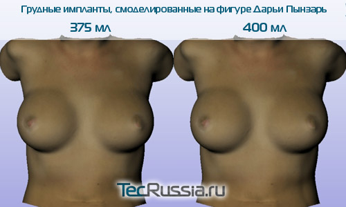 http://www.tecrussia.ru/uploads/posts/2012-05/1337860090_daria_pynzar_do_i_posle_1.jpg