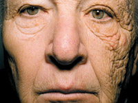 Результаты 28-летнего воздействия солнца на кожу лица