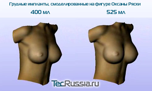 Оксана Ряска – фото до и после пластических операций