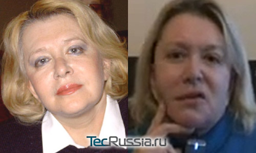Алена Галич – фото до и после неудачной пластической операции