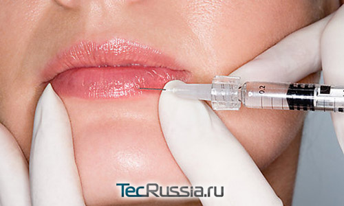 как удалить гиалуроновую кислоту из губ?