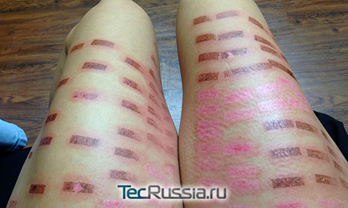 повреждения кожи после лазерной эпиляции