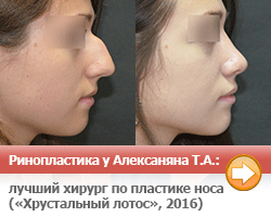 228Кто в россии лучше делает ринопластику