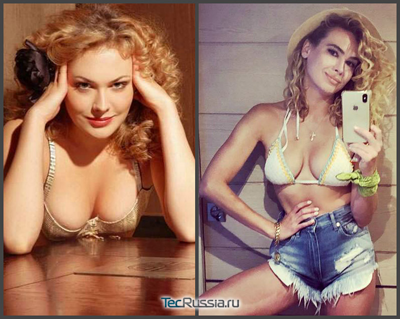 Анна Горшкова до и после пластики груди