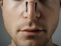Септопластика – коррекция носовой перегородки