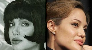 Анжелина Джоли – фото до и после пластических операций