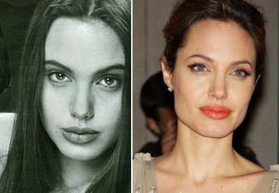 Анджелина Джоли – фото до и после пластических операций