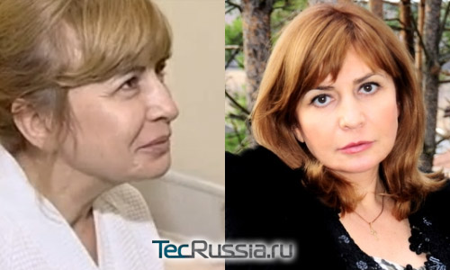 Ирина Агибалова из Дома-2 – фото до и после пластических операций