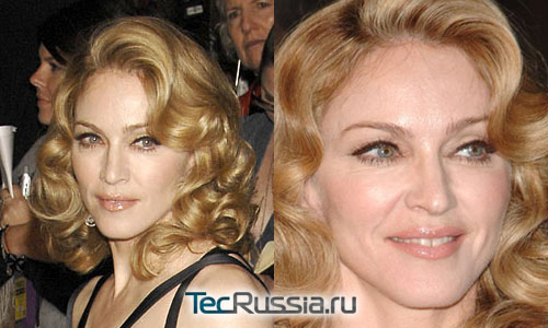 Мадонна – фото до и после пластических операций