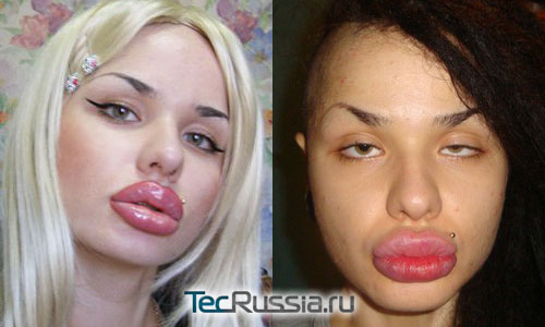 Кристина Рэй – самые большие в мире губы