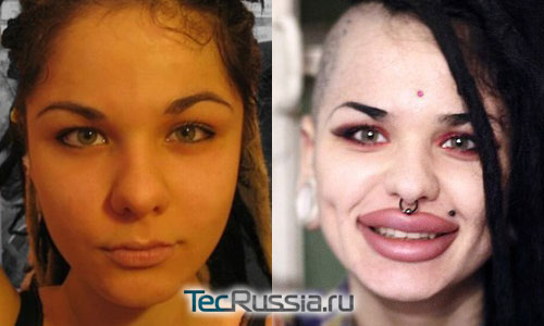 Кристина Рэй – фото до и после пластических операций