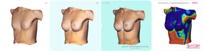 Моделирование груди с помощью методики 3D FORM
