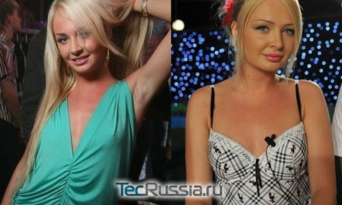 Дарья Пынзарь – фото до и после пластических операций