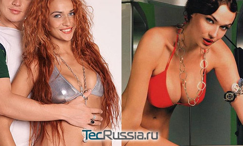 Алена Водонаева из Дома-2 – фото до и после пластических операций