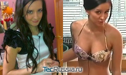 Рита Агибалова из Дома-2 – фото до и после пластических операций