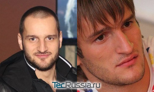 Алексей Самсонов – фото до и после пластической операции