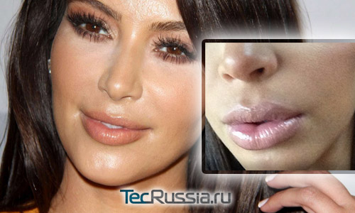 Ким Кардашян увеличила губы