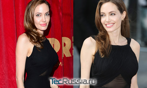 Анджелина Джоли после удаления груди
