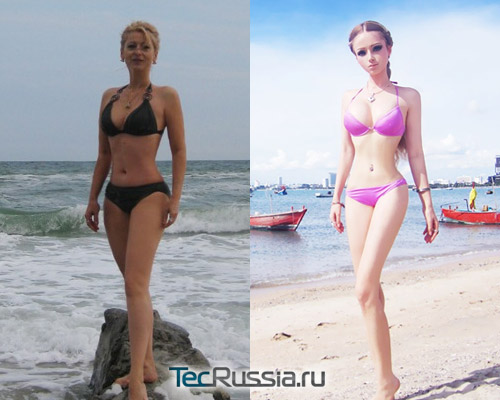Валерия лукьянова до и после пластики thumbnail