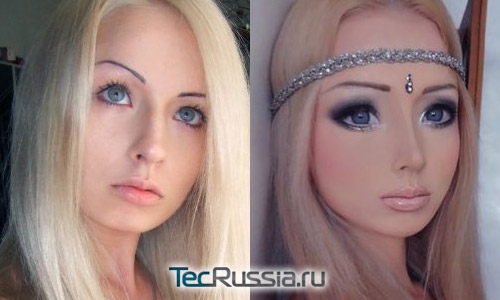 Валерия Лукьянова до и после пластических операций