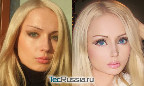 Лукьянова валерия до и после операции thumbnail