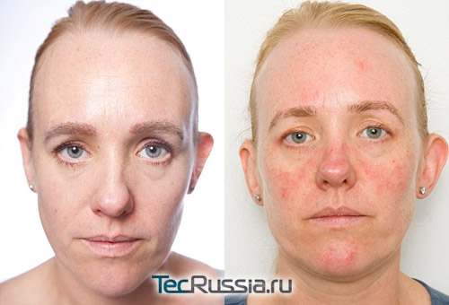 30 дней с макияжем на лице: результаты воздействия косметики на кожу
