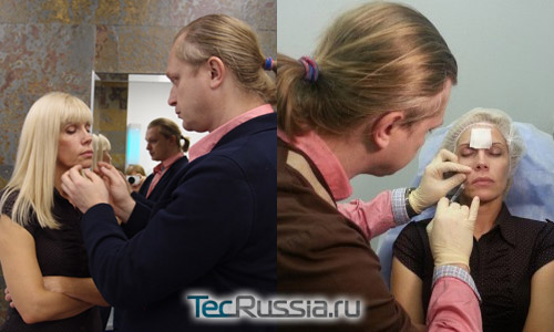 Светлана Устиненко (мама Алианы) – пластические операции, фото до и после