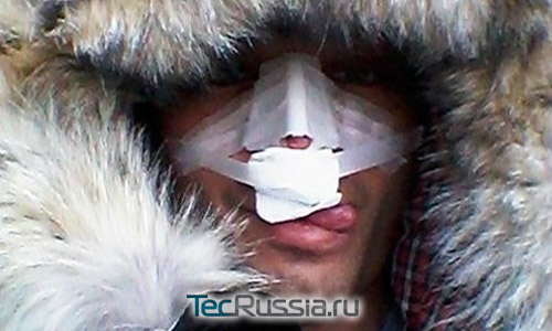 Первое фото носа Рустама Солнцева после пластической операции