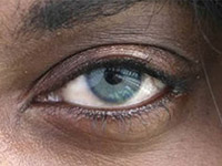 Новинка: операция по смене цвета глаз с помощью имплантов