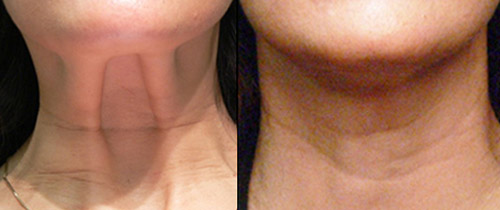 процедуры для кожи лица и шеи thumbnail