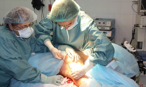 операция на потовые железы