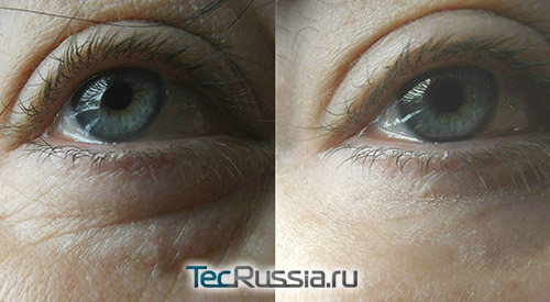 Jeunesse Instantly Ageless – фото до и после