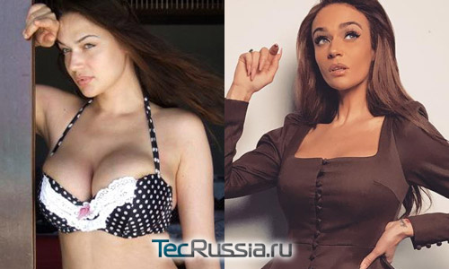 Алена Водоаева до и после уменьшения груди