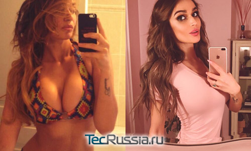 грудь Водонаевой стала на два размера меньше – фото до и после операции