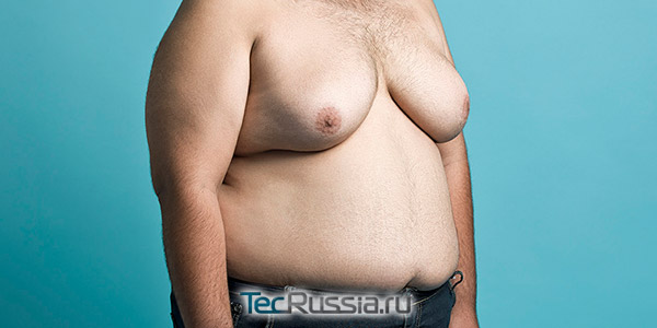 гинекомастия - увеличенная грудь у мужчины