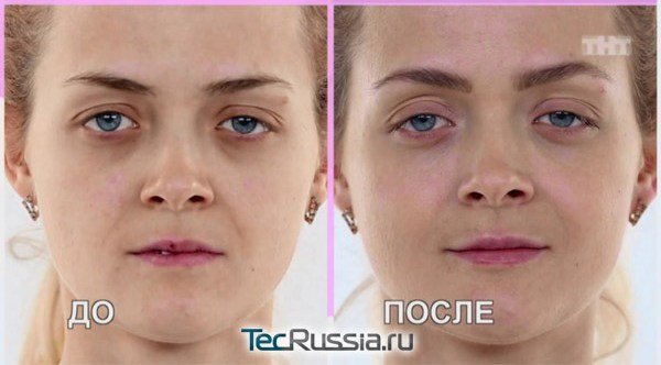 Юнона до и после косметолога