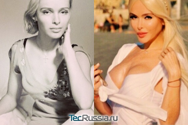 Алена Кравец до и после увеличения груди