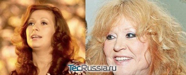 Алла Пугачева старение