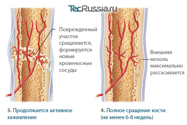 сращение носа после хирургической травмы