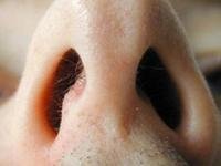 Что такое гребень носовой перегородки и почему от него нужно избавляться