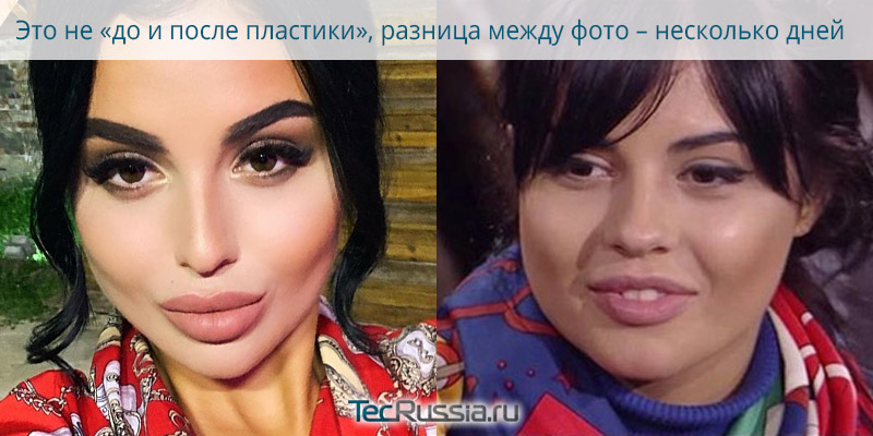Ян ян до и после пластики
