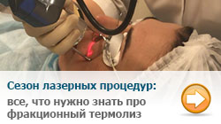фракционный лазер