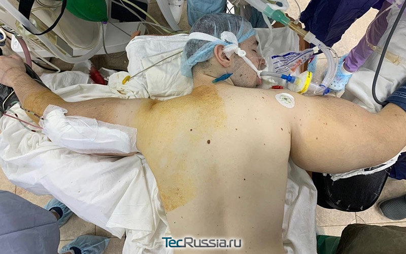 Кирилл Терешин на операции по удалению рук-базук