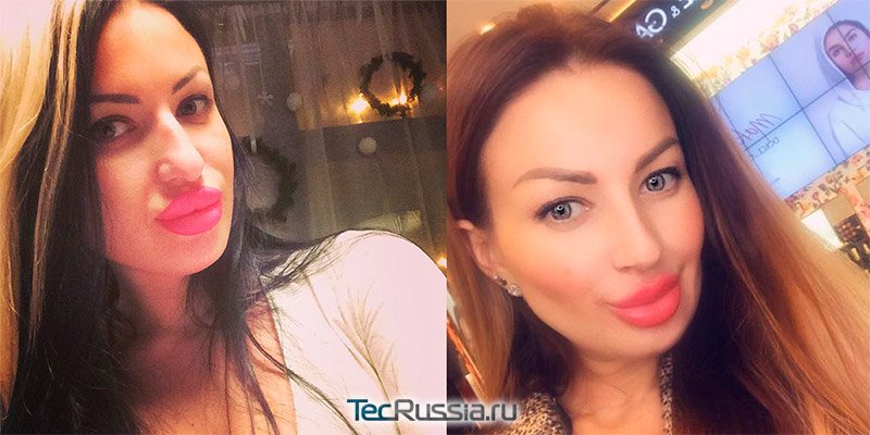 фото Юлии Ряданцевой до и после пластики носа