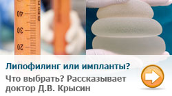 что выбрать: липофилинг или импланты?